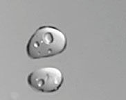 水滴拡大図